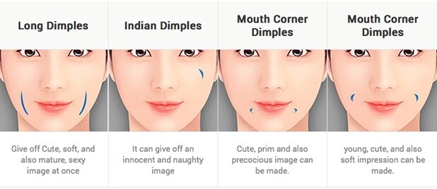 Methods of dimple creation surgery in Mumbai.