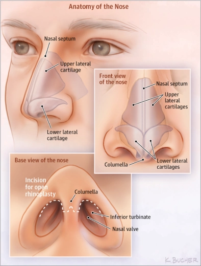 Rhinoplasty in Mumbai, best Rhinoplasty surgeon in Mumbai, Rhinoplasty in India, best Rhinoplasty surgeon in India, best plastic surgeon in India, best plastic surgeon in Mumbai, Dr Siddharth Prakash, Ambrosia Aesthetics, best nose surgeon in india, nose surgery,
